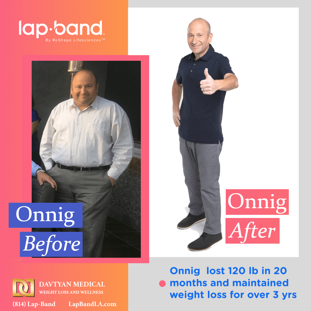 Onnig After Weight Loss Poster